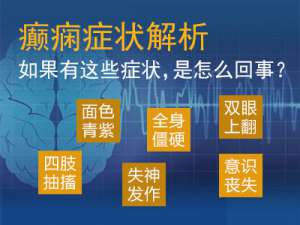 成都专业治癫痫病的医院？癫痫发病抽搐原因是什么？